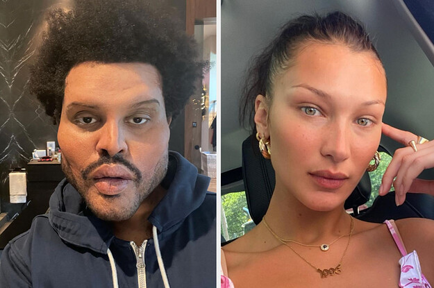 Fans Think The Weeknd’s Plastic Surgery Look Is A Reference To Ex Bella Hadid